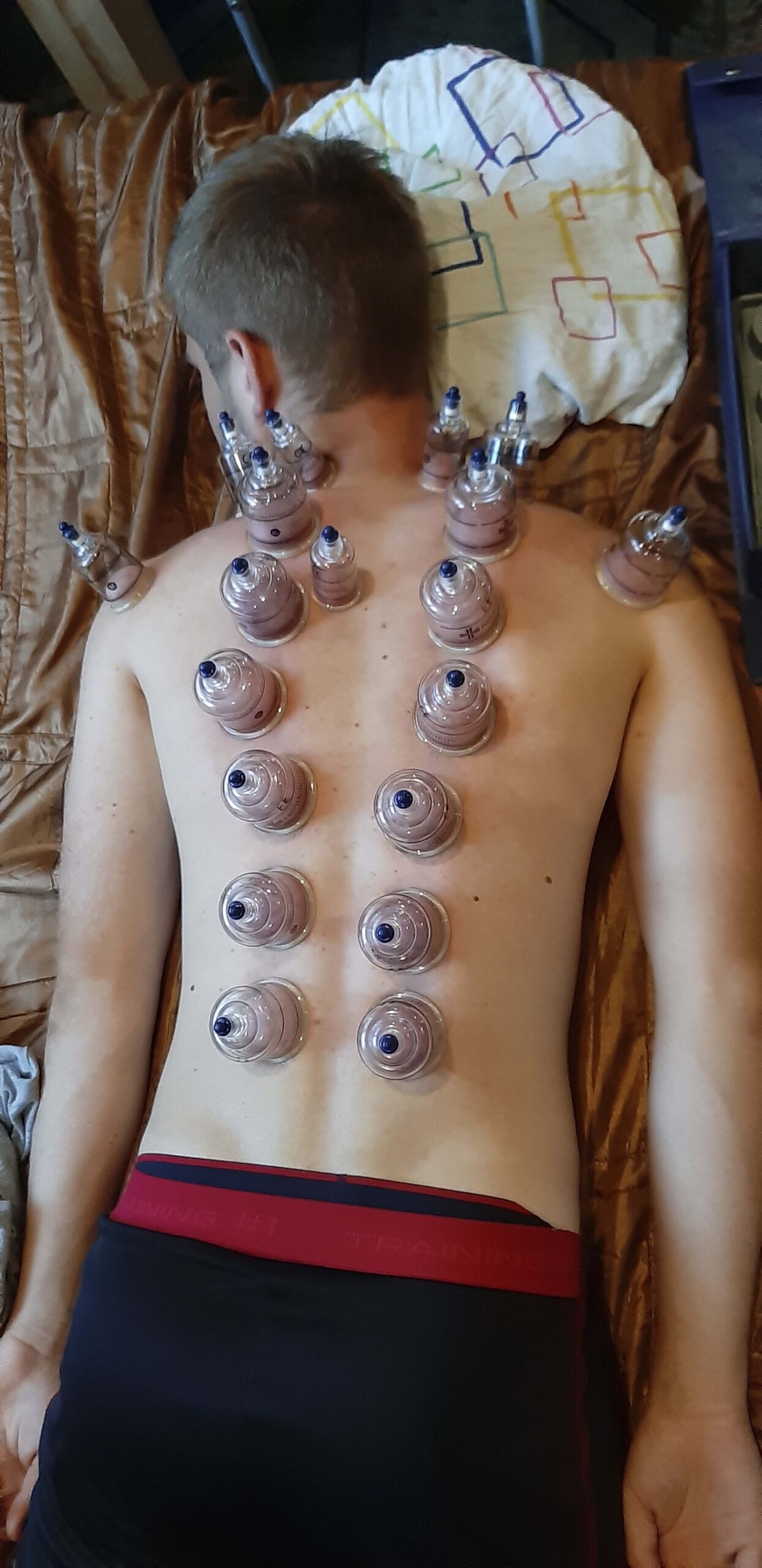 Köpölyözés_2