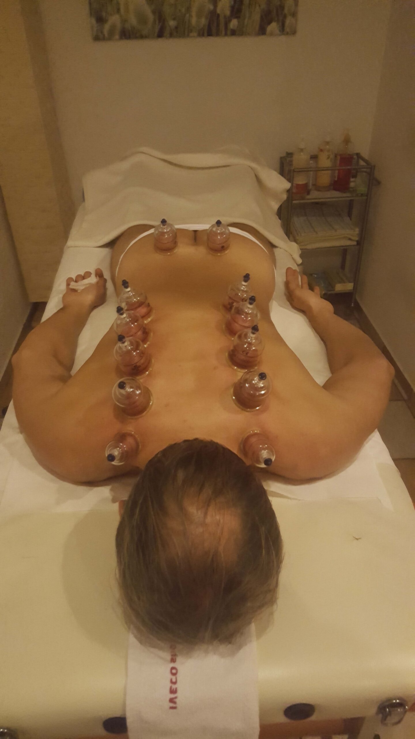 Köpölyözés_4
